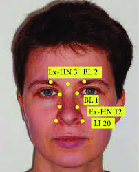 Standardised Point Chart For Facial Acupuncture Download
