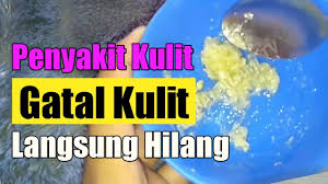 Jun 21, 2021 · ada beberapa cara mencegah insomnia yang perlu anda ketahui, diantaranya : Info Penting Cara Mengobati Gatal Pada Kulit Yang Tak Kunjung Sembuh Obat Gatal Pada Kulit Alami Sehat Cara Mudah Bulan Juni 2020 Jazz Indonesia