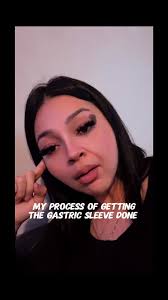 My Gastric Sleeve Surgery Journey in Tijuana