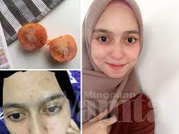 Makin sapu makin cantik alhamdulilah , kini puan aisyah kulit lebih cantik licin , halus , putih dan tiada lagi kesan parut jeragat ,jerawat , bintik hitam , tompok. 8 Bulan Wanita Ini Cuci Muka Guna Tomato Beku Kesannya Hilang Habis Jerawat Degil Kulit Pinkish Berseri Mingguan Wanita