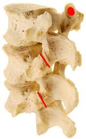 Patients are shown how to improve . Neck And Back Pain Is It The Facet Joint