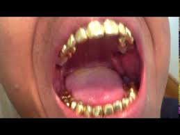 Check out our gold teeth selection for the very best in unique or custom, handmade pieces from our jewelry sets shops. Ultimate Guide For Permanent Gold Teeth Updated