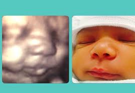 Especially if the practitioner doesn't offer this level of ultrasound testing. 3d Ultrasound 4d Ultrasound New York Ny Nyc Sono Baby Studio