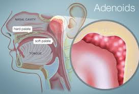 Quizlet flashcards, activities and games help you improve your grades. Adenoids Human Anatomy Picture Function Location More