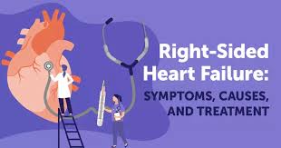 Image result for Right Heart Failure