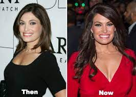 The kimberly guilfoyle plastic surgery might be rumored but it's clear that she has enhanced looks for some parts of her body. Kimberly Guilfoyle Plastic Surgery Before And After Photos Plastic Surgery Surgery Kimberly Guilfoyle