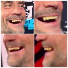 What are the teeth options