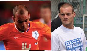 Born 9 june 1984) is a dutch retired professional footballer. Wesley Sneijder Hair Journey How He Recovered From Hair Loss Hairy Jimbo