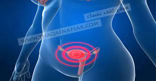 تعرفي على ألم المبيضين أسبابه وطرق علاجه ثقف نفسك