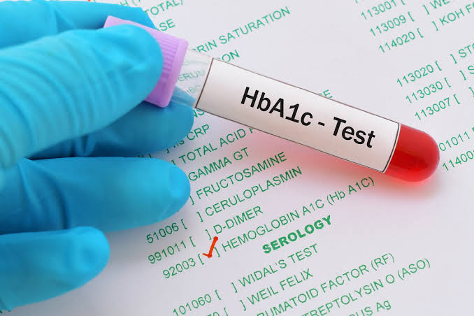 HbA1C Test: Procedure, Results & Levels Explained | Healthengine Blog