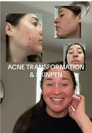 Mount Austin Local Spa