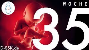 35 Ssw 35 Schwangerschaftswoche D Ssk De Youtube