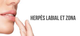 Herpes Labial Et Zona Differences Origine Et Traitements