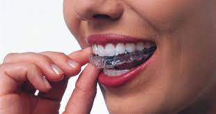 Invisalign Is Undetectable To Others And Removable In This Way It Does Less Impact On Your Everyday Life Get To Th Invisalign Dental Braces Dental Photography