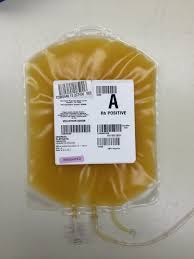 Image result for Platelet Transfusion
