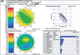 Pe la noi prin teleorman — marin cornea. How Technology Can Help The Irregular Cornea
