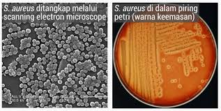 Ada beberapa jenis penyakit jantung, namun yang paling dominan adalah penyakit jantung koroner. Bakteria Dan Virus Sama Tapi Tidak Serupa Amanz