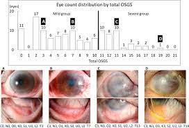 Predictive Biomarkers For The Progression Of Ocular Complications In Chronic Stevens Johnson Syndrome And Toxic Eeidermal Necrolysis Scientific Reports