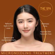 𝐓𝐚𝐤𝐞 𝐚𝐝𝐯𝐚𝐧𝐭𝐚𝐠𝐞 𝐨𝐟 𝐭𝐡𝐞 𝐫𝐚𝐢𝐧𝐲 𝐬𝐞𝐚𝐬𝐨𝐧 𝐟𝐨𝐫  𝐲𝐨𝐮𝐫 𝐌𝐢𝐜𝐫𝐨𝐧𝐞𝐞𝐝𝐥𝐢𝐧𝐠 𝐓𝐫𝐞𝐚𝐭𝐦𝐞𝐧𝐭! 🌧️ Did you know  that rainy days are an ideal time for microneedling? With less sun  exposure, your skin can recover more