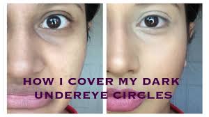 how to er dark under eye circles