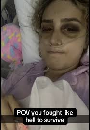 Lesrning Go Walk Again After Accident