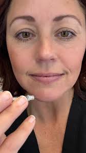 Bringing the heat to Miami. 🔥🫦 Hope your girls trip was a blast babe!  Dying over her gorgeous skin too. 💕 #Beautifullips #happylips #prettylips  #lips #lipfiller #lippop #kysse #kysselips #subtleenhancement #lessismore