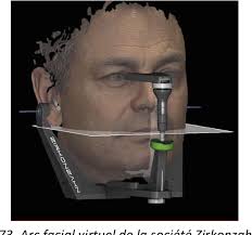 Figure 73 from L'articulateur virtuel du Cerec Software 4.2 : véritable  outil de diagnostic ou simple aide à la modélisation d'éléments  prothétiques ?