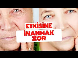 Etkisine Inanamayacaginiz Maske Lalə Gasimova Youtube 2020 Cilt Bakimi Tuyolari Cilt Bakimi Ev Yapimi Cilt Bakimi