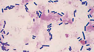 Check spelling or type a new query. Clostridium Perfringens Alchetron The Free Social Encyclopedia