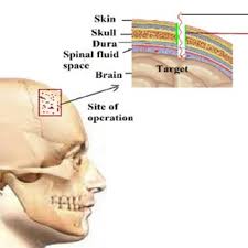 What are the … expected phenotypes of their offspring and in. Cross Section Of Human Bone Morphology 19 Download Scientific Diagram