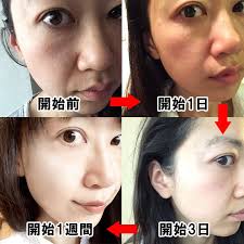 エイジング おしゃれまとめの人気アイデア pinterest みき 小顔 ダイエット スキンケア エイジング