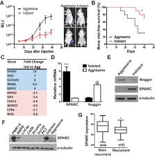 Secreted Protein Acidic And Rich In Cysteine Sparc Mediates Metastatic Dormancy Of Prostate Cancer In Bone Journal Of Biological Chemistry