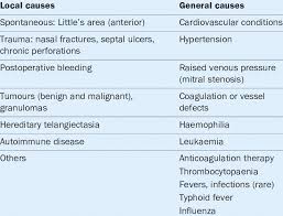 Image result for Epistaxis
