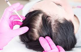 الميزو للشعر فوائد الميزو للشعر 2021 تجميلي اسطنبول