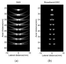 Situated at the corner of yonge street and steeles avenue, toronto. Applied Sciences Free Full Text Broadband Generalized Sidelobe Canceler Beamforming Applied To Ultrasonic Imaging Html