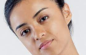 We did not find results for: Do Accutane Results Outweigh The Side Effects Realself