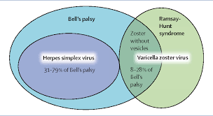 This chapter discusses the pathology, pathophysiology, epidemiology, evaluation, and management of these common disorders. Figure I From Steroid And Antiviral Treatment For Bell S Palsy Semantic Scholar