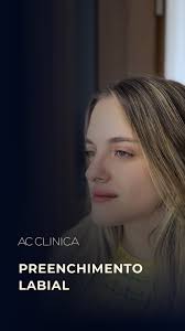 O resultado que apenas 1ML foi capaz de trazer, tendo sido aplicado de  forma estratégica!, ., ., ., #acclínica #drarmandocunha  #PreenchimentoLabial, #LábiosPerfeitos, #HarmonizaçãoOrofacial, ...