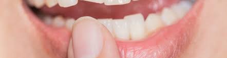 Use floss to pull out the tooth. Chipped Tooth Here S What To Do Immediately After And Potential Fixes