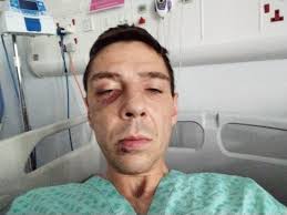 Prayer request for brother with brain injury