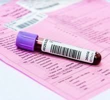 La prise de sang est un examen relativement courant effectuée en laboratoire d'analyse par un biologiste, un technicien préleveur ou un infirmier. Transaminases Definition Et Analyse Des Resultats
