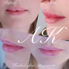 •lip neutralization is perfect for clients who have uneven lip color, cool tone lips, or dark/hyperpigmentation lips. Semi Permanent Lips Annette Kemp