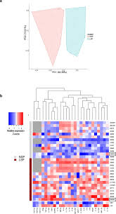 Check spelling or type a new query. Leukocytospermia Induces Intraepithelial Recruitment Of Dendritic Cells And Increases Siv Replication In Colorectal Tissue Explants Communications Biology