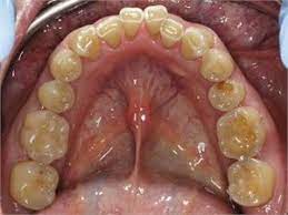 Pin On Dental