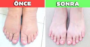 Health Tips Panosundaki Pin