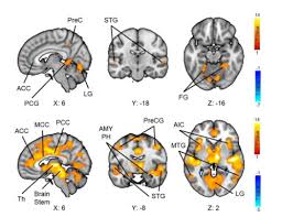 100 movies you have to see before you die! Horror On The Brain Finnish Researchers Map Mental Impact Of Watching Scary Movies Ctv News