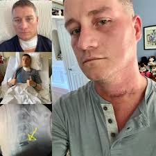 Approving new members after surgery and recovery