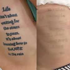 How does laser tattoo removal work? Procent Freca Cupru Does Laser Tattoo Removal Work Callumluckwellfinalyear Com