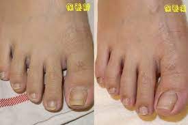 Search for text in url. æ›¾ä¹‹å–¬ ä¿é¤Š Nubaby å¦®å¯¶è²è¶³éƒ¨ä¿é¤Šåˆ†äº«