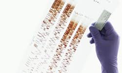 Sequence data analysis has become a very important aspect in the field of genomics. How Dna Profiling Works Howstuffworks